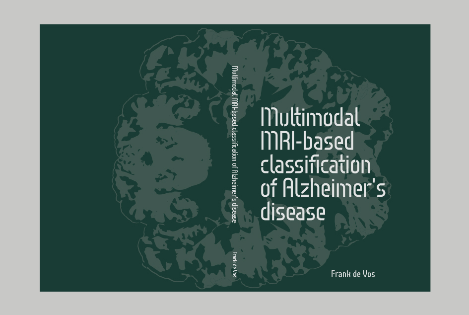 PROEFSCHRIFT ONTWERP: FRANK DE VOS – MULTIMODAL MRI-BASED CLASSIFICATION OF ALZHEIMER’S DISEASE