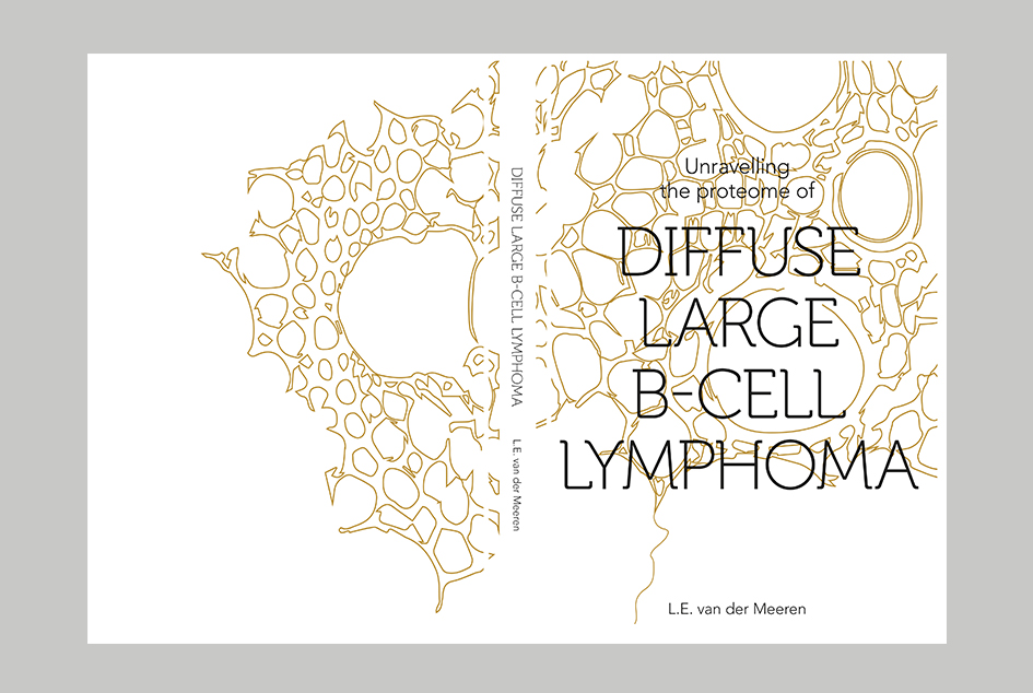 PROEFSCHRIFT ONTWERP: LOTTE VAN DER MEEREN – UNRAVELLING THE PROTEOME OF DIFFUSE LARGE B-CELL LYMPHOMA